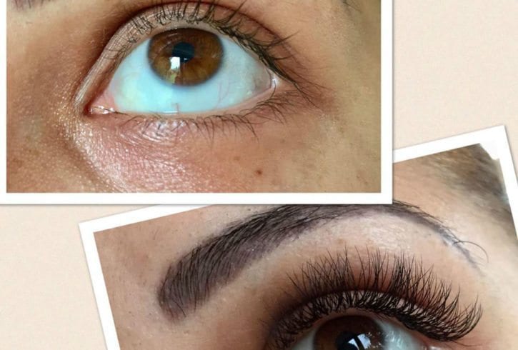 Extensii Gene - zona Lewisham