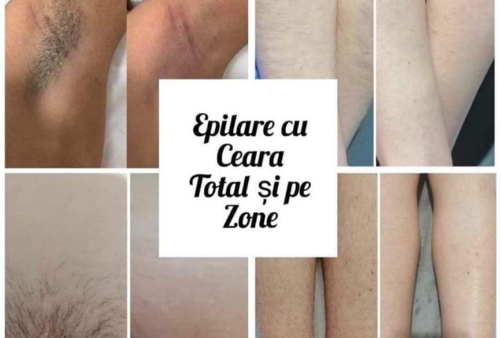 Servicii De Epilare In Woking, UK