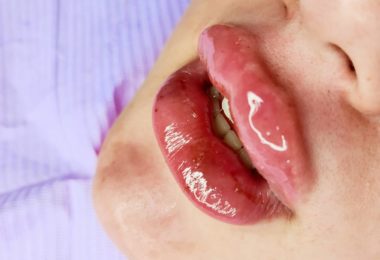 Tratamente Estetice Si Cosmetice In Manchester, UK