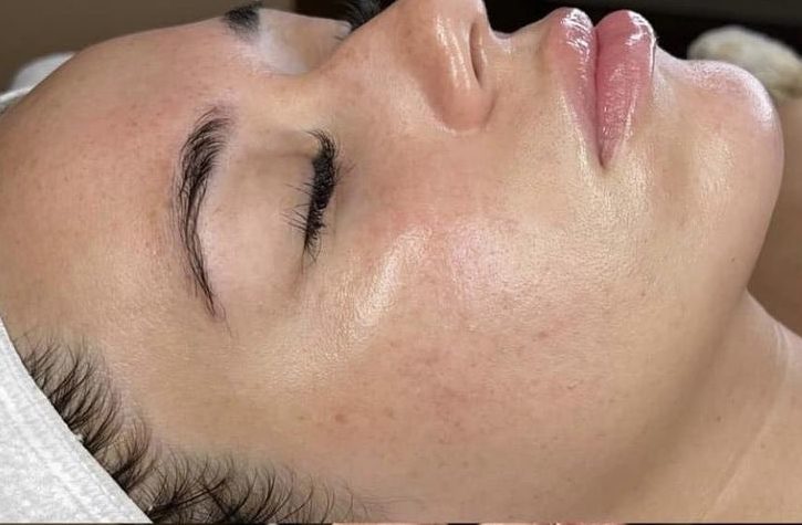 Salon De Tratamente Faciale In Watford, Londra