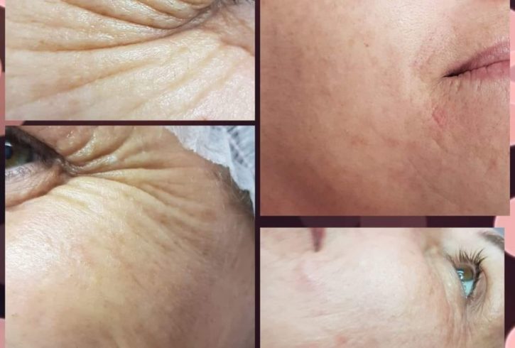 Tratamente Estetice Si Cosmetice In Manchester, UK