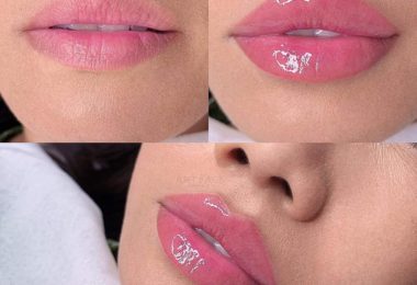 Lady D Aesthetics - Tratamente Estetice In Manchester, UK