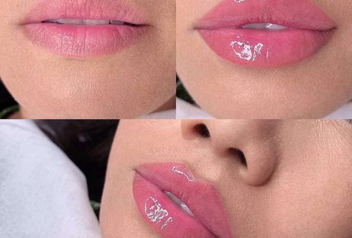 Lady D Aesthetics - Tratamente Estetice In Manchester, UK Lady D Aesthetics - Tratamente Estetice In Manchester, UK