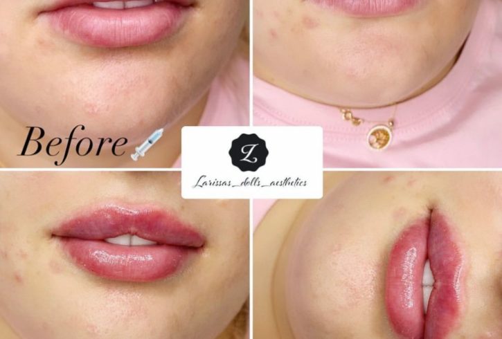 Servicii De Cosmetica In Edgware, Londra