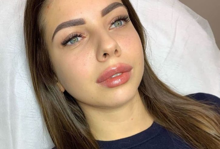 Servicii De Injectare Buze Cu Acid Hialuronic In Watford, Londra