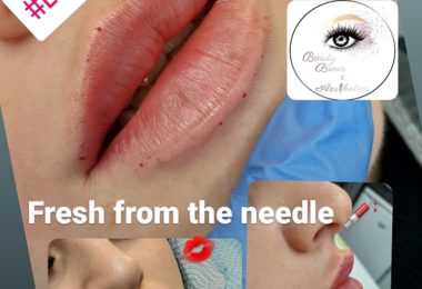 Servicii De Microblading Si Augmentare Buze In Nottingham, UK