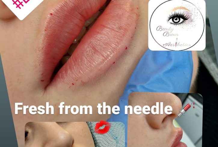 Servicii De Microblading Si Augmentare Buze In Nottingham, UK