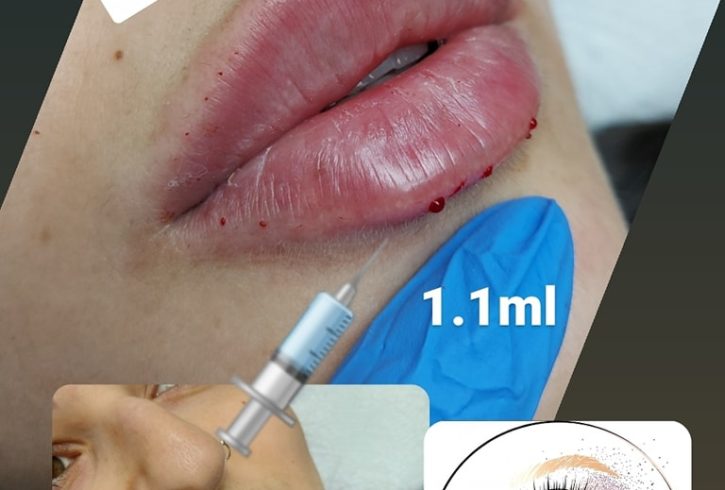 Servicii De Microblading Si Augmentare Buze In Nottingham, UK