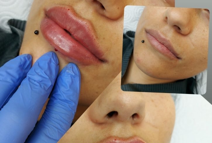 Servicii De Microblading Si Augmentare Buze In Nottingham, UK