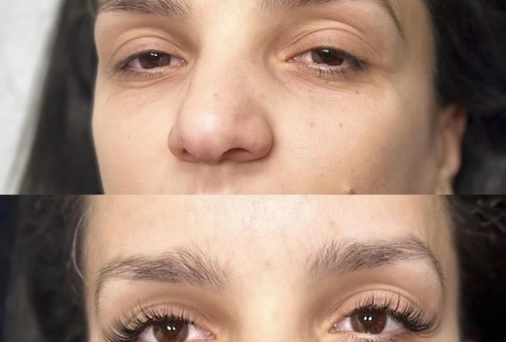 Extensii De Gene In Brentford, Londra