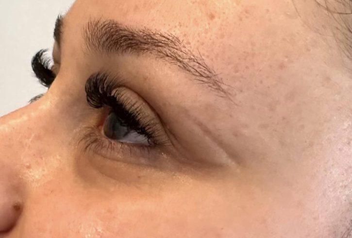 Extensii De Gene In Brentford, Londra