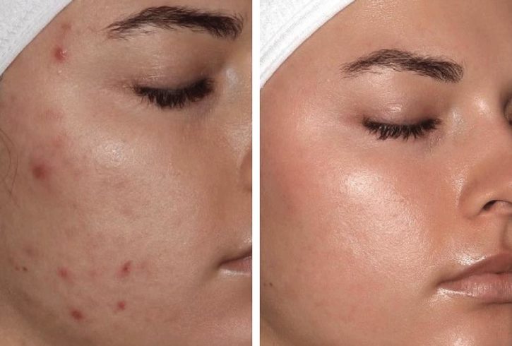 Salon Tratamente Faciale Si Botox In Croydon, Londra