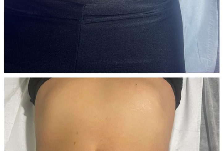 Salon De Remodelare Corporala Si Faciala In Harrow, Londra