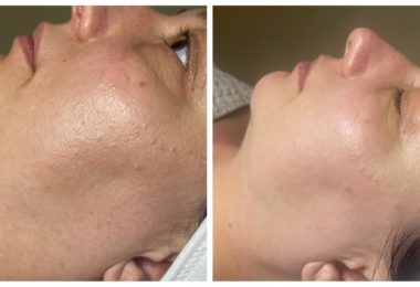 Salon De Remodelare Corporala Si Faciala In Harrow, Londra