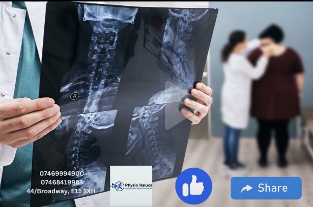 Fizioterapie in Londra cu Medici Romani - E15 1XH