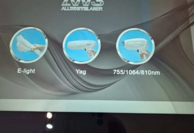 Epilare Definitiva Cu Laser Dioda In Leytostone, Londra