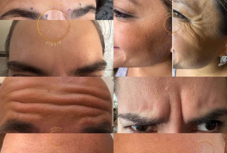 Tratamente De Infrumusetare In Chatham, UK