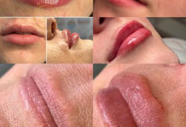 Tratamente De Infrumusetare In Chatham, UK