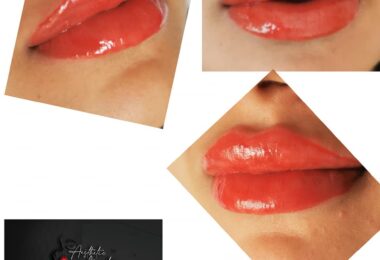 Salon De Infrumusetare Acid Hialuronic Si Gene In Barking, Londra