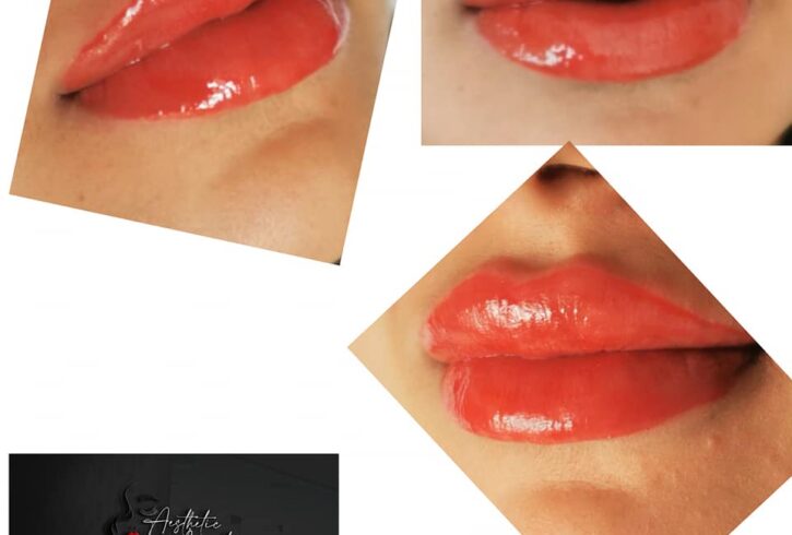 Salon De Infrumusetare Acid Hialuronic Si Gene In Barking, Londra