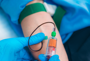 Clinica Medazur Angajează Phlebotomist in Redbridge, Londra