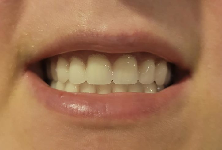 Servicii Stomatologice Implanturi in Leicester, UK Servicii Stomatologice Implanturi in Leicester, UK