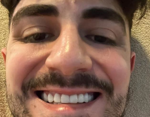 Servicii Stomatologice Implanturi in Leicester, UK Servicii Stomatologice Implanturi in Leicester, UK