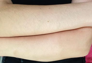 Servicii de Cosmetica in Waltham Abbey, Essex - Nikole Glam Skin