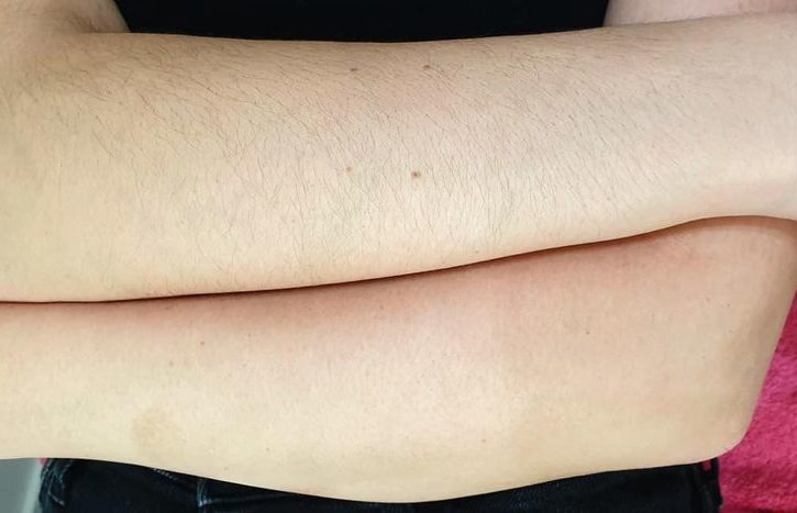 Servicii de Cosmetica in Waltham Abbey, Essex - Nikole Glam Skin