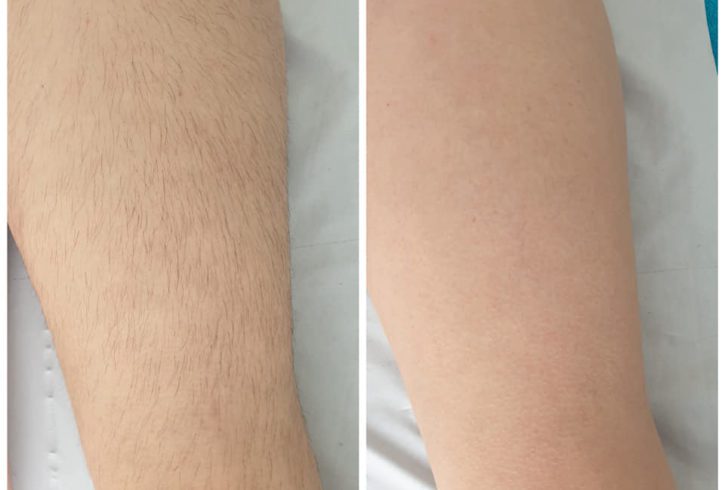 Servicii de Cosmetica in Waltham Abbey, Essex - Nikole Glam Skin