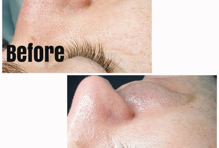 Servicii de Cosmetica in Waltham Abbey, Essex - Nikole Glam Skin