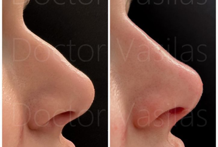 Mayfair Clinic London - Tratamente Estetice In Mayfair, Londra