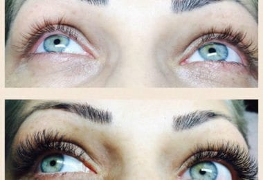 Extensii Gene - zona Lewisham