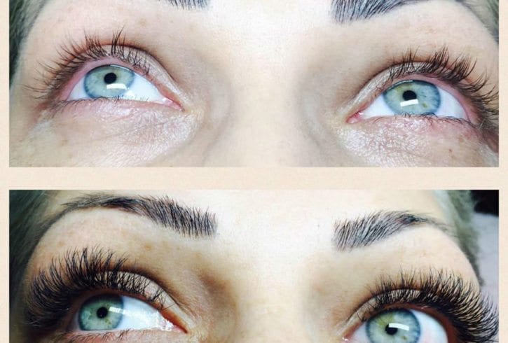 Extensii Gene - zona Lewisham