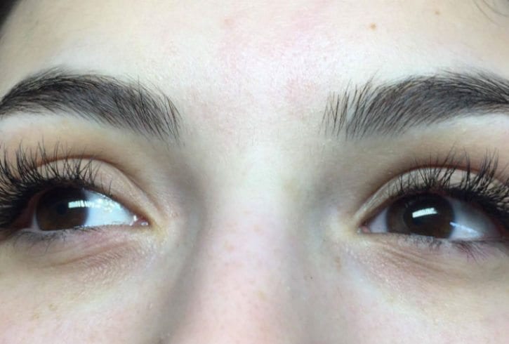 Extensii Gene - zona Lewisham