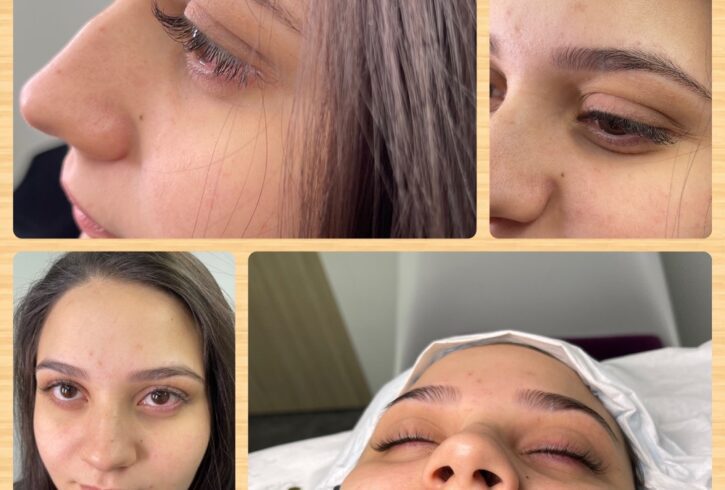 Extensii De Gene Fir Cu Fir in Plaistow, Newham