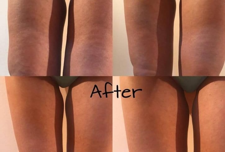 Massage therapeutic Angelica Pop Ilford Londra IG3 Massage therapeutic Angelica Pop Ilford Londra IG3