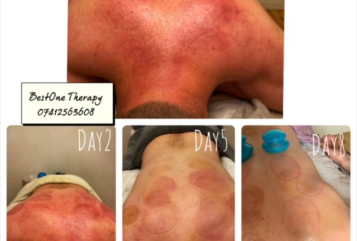 Masaj Terapeutic in Londra UK Masaj Terapeutic in Londra UK